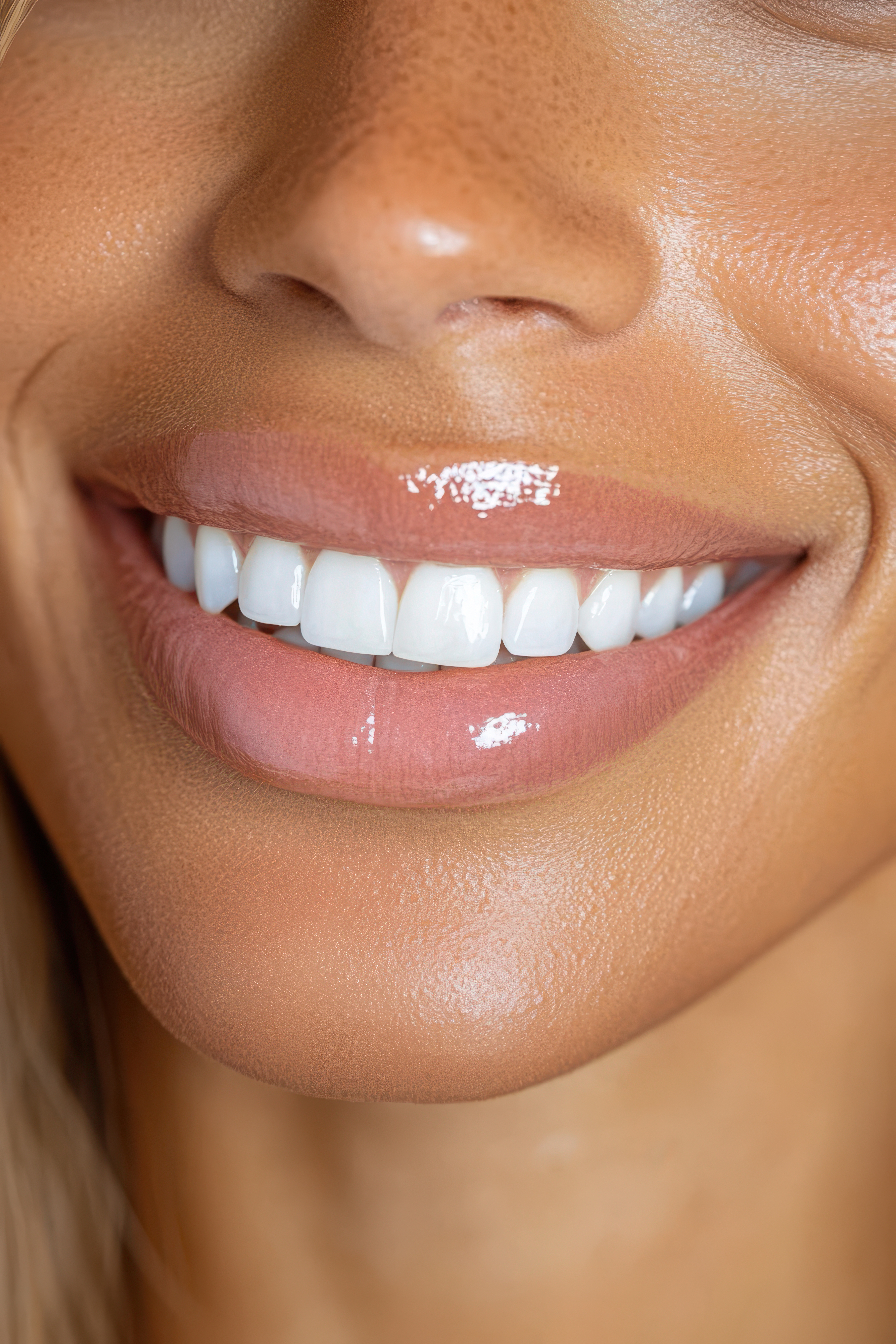 Teeth whitening smile