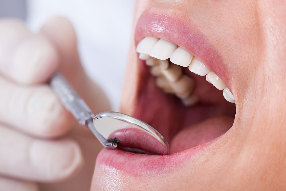 White fillings treatment