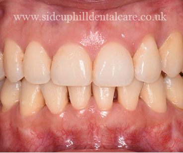 Case Study 1 After Treatment