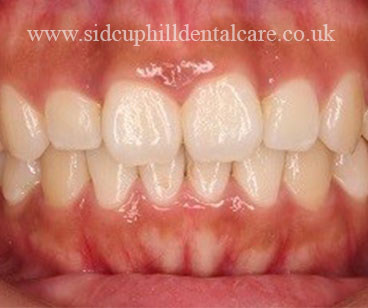 Case Study 2 After Treatment