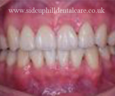 Case Study 4 After Treatment