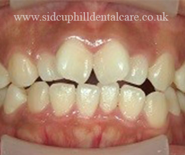 Case Study 2 Before Treatment