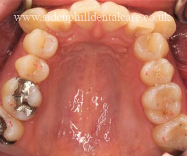 Case Study 3 Before Treatment
