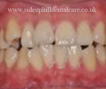 Case Study 4 Before Treatment