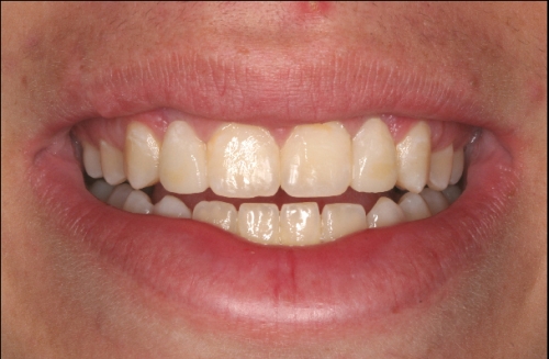 AFTER treatment