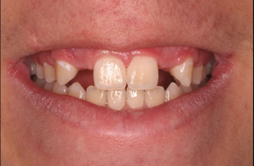 BEFORE treatment