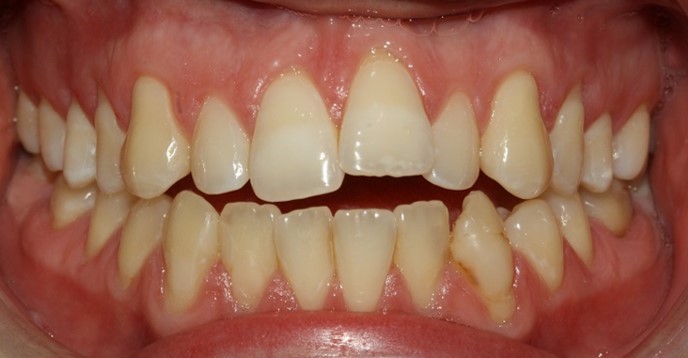 BEFORE treatment