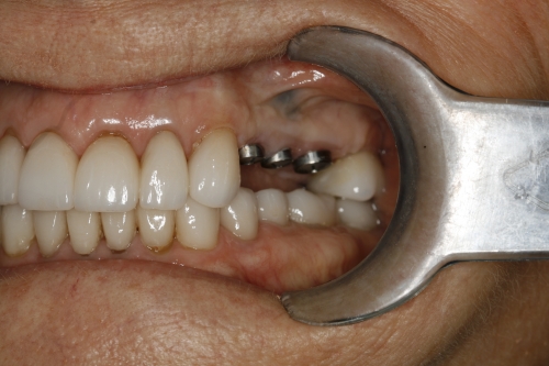BEFORE treatment