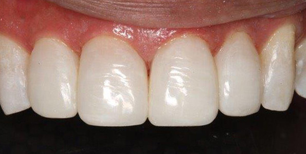 AFTER treatment