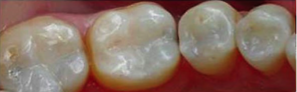 AFTER treatment