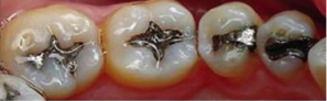 BEFORE treatment