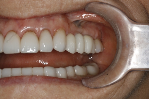 AFTER treatment