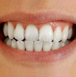 AFTER treatment